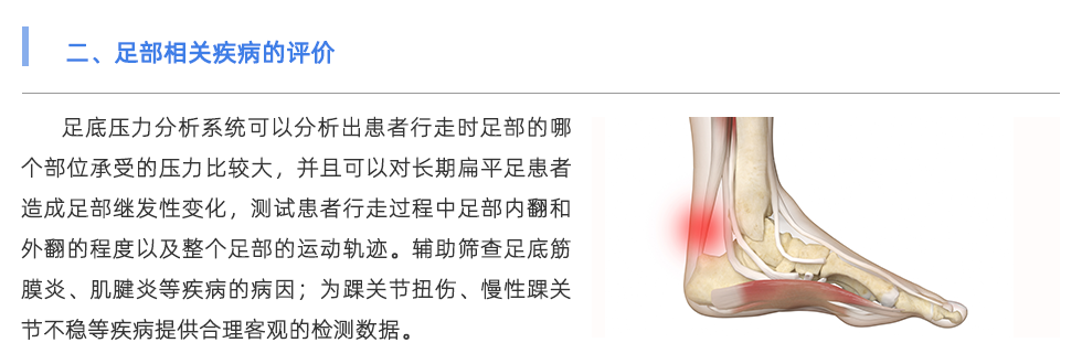 足底压力分析系统