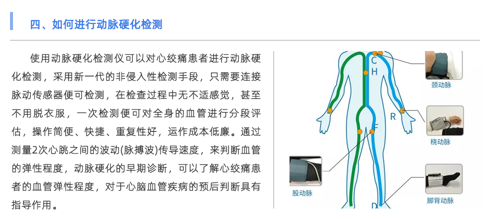 动脉硬化检测仪