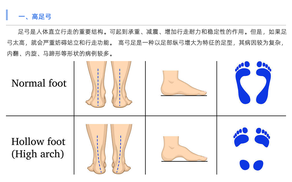 步态分析仪