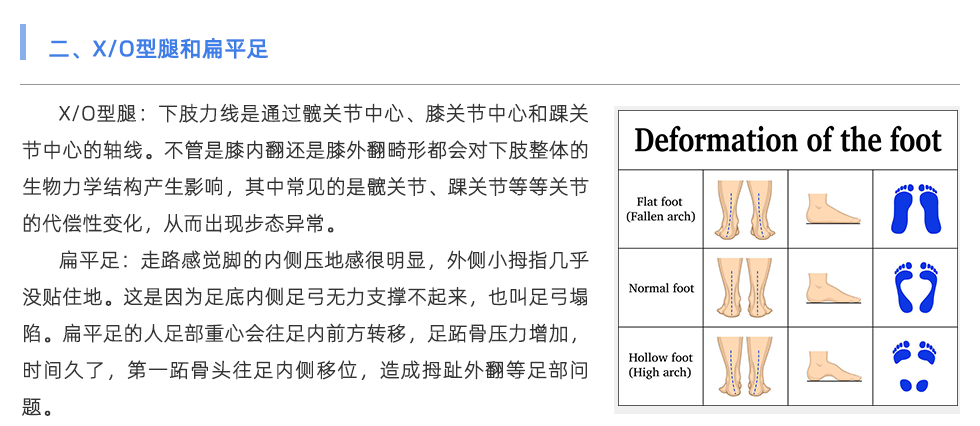 足底压力分析系统