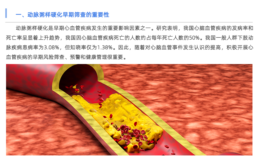 动脉硬化检测仪