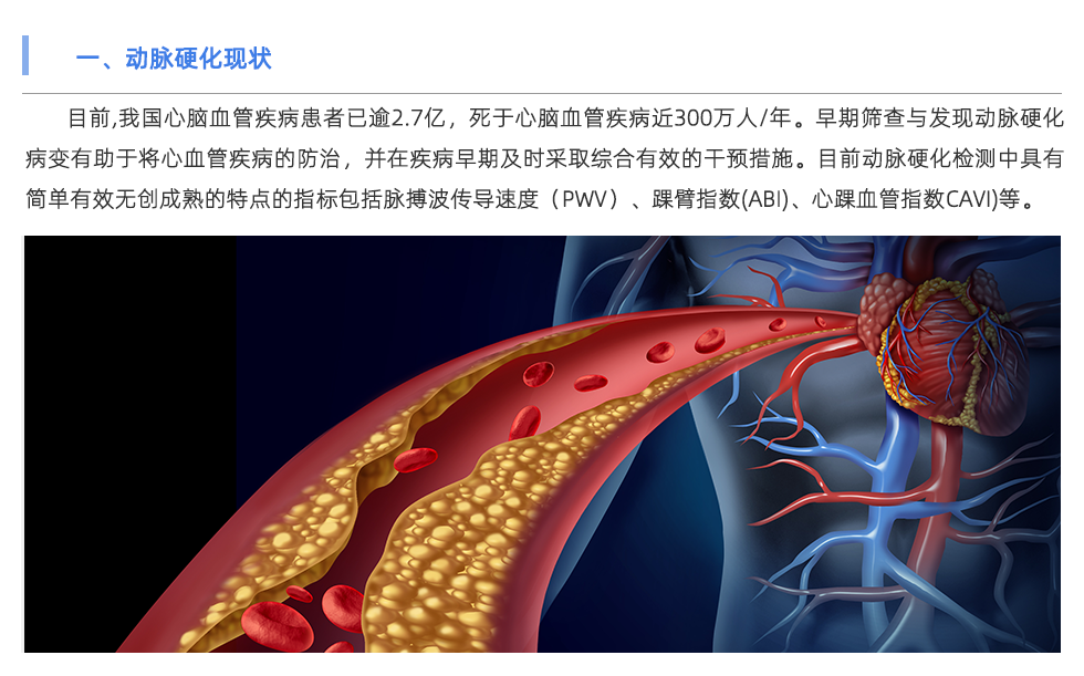 动脉硬化检测仪