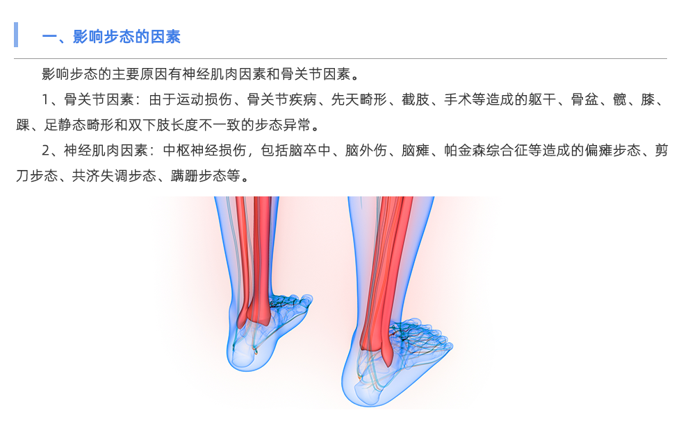 步态分析仪