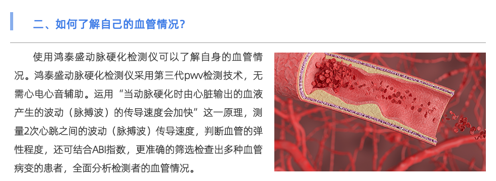 动脉硬化检测仪