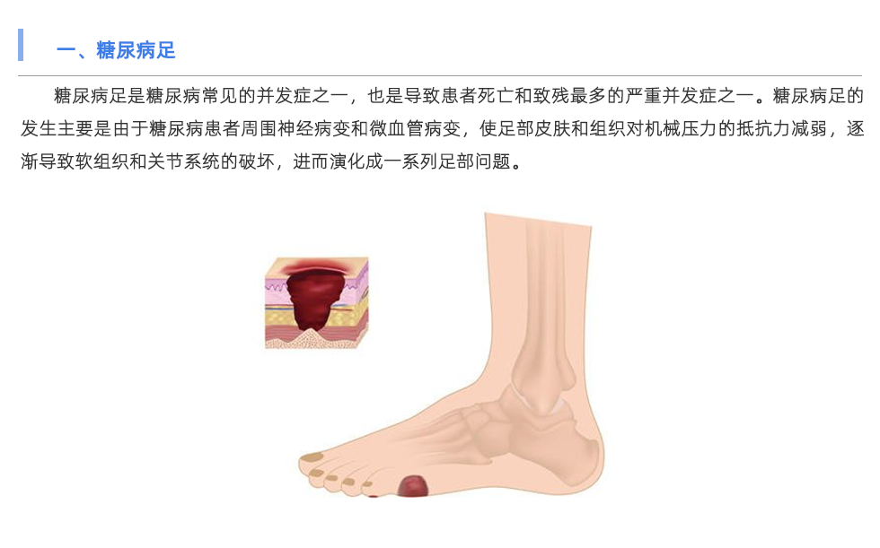 定制鞋垫