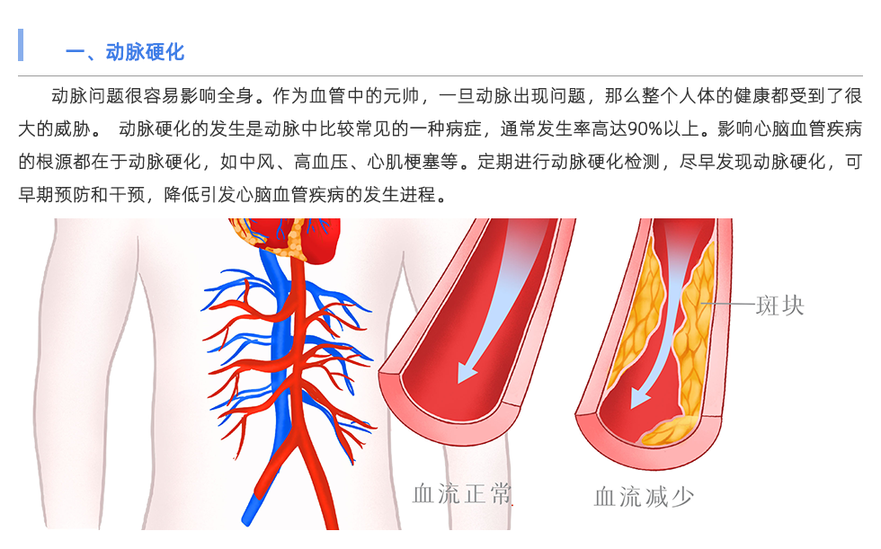 动脉硬化检测仪