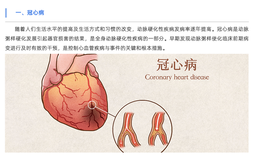 动脉硬化检测仪
