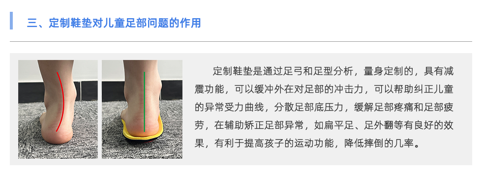 定制鞋垫