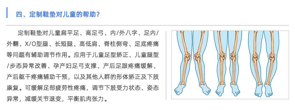 定制鞋垫