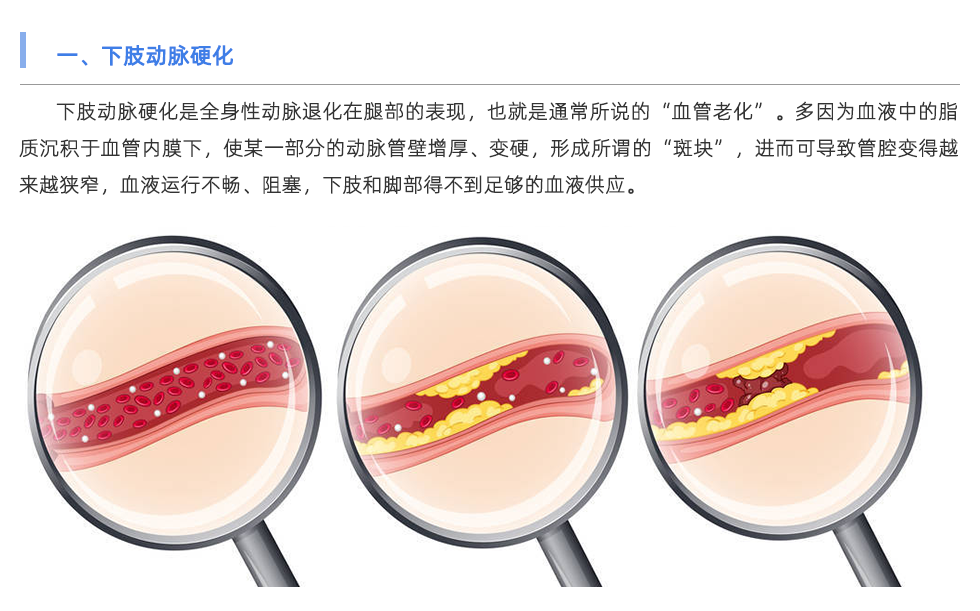 动脉硬化检测仪
