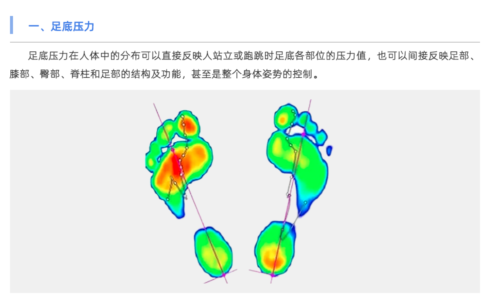 足底压力分析仪