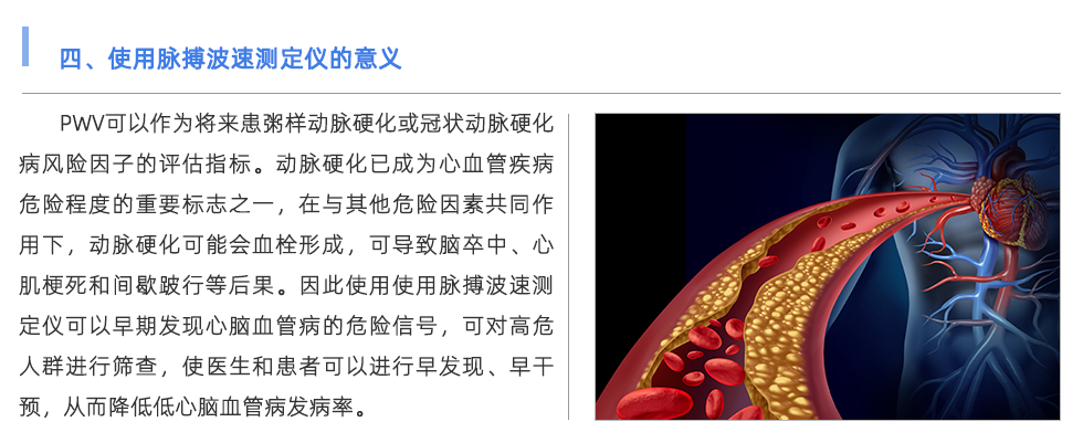 脉搏波速测定仪