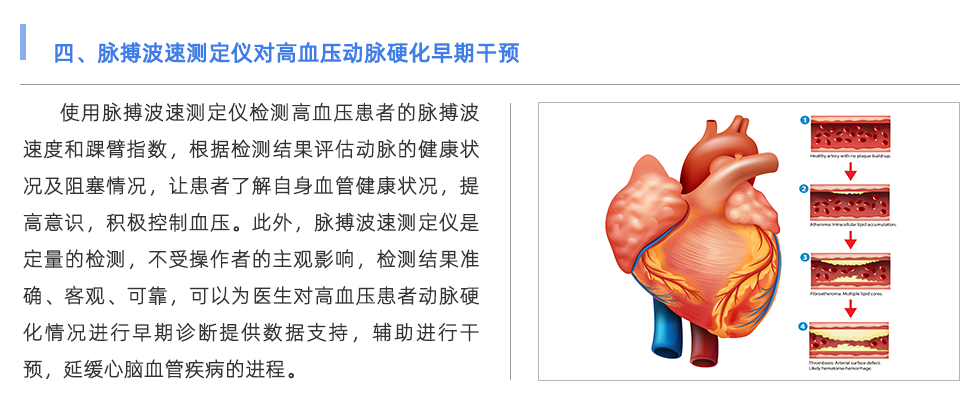 脉搏波速测定仪