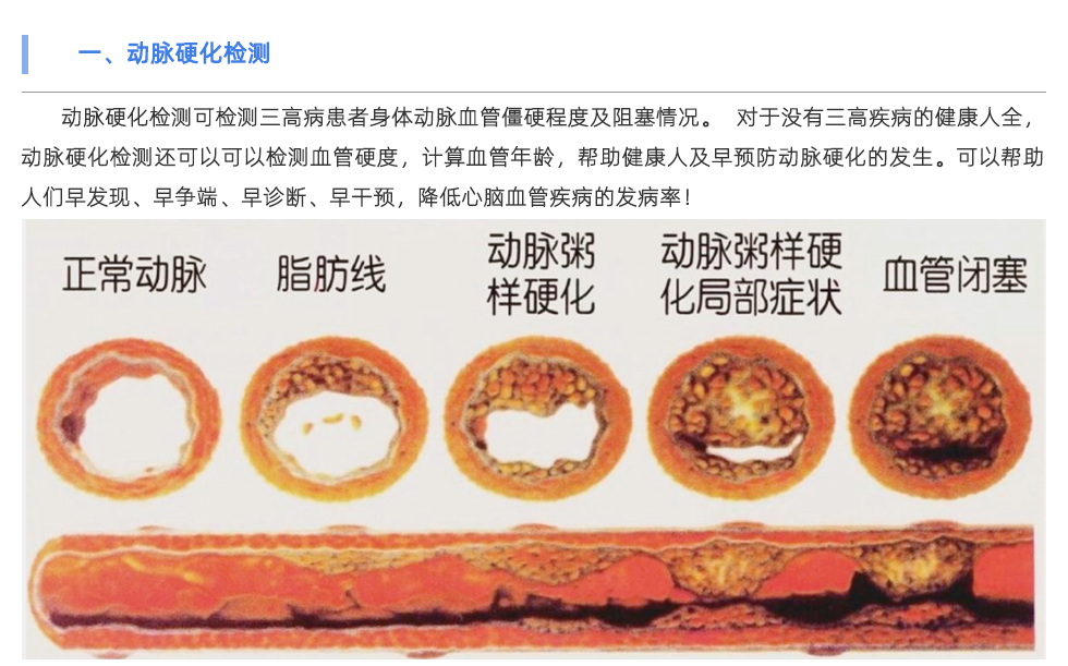 动脉硬化检测仪