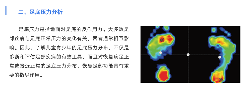足底压力分析系统