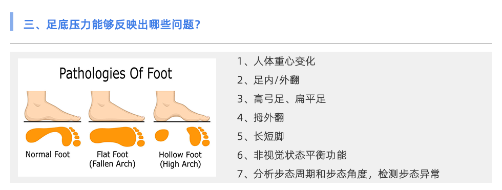 足底压力分析系统