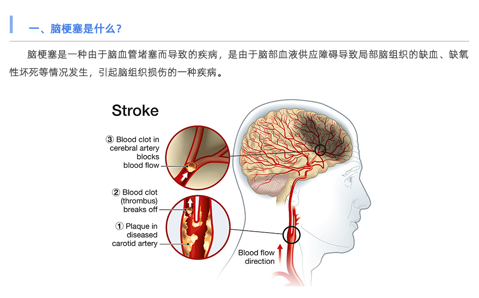 动脉硬化检测仪