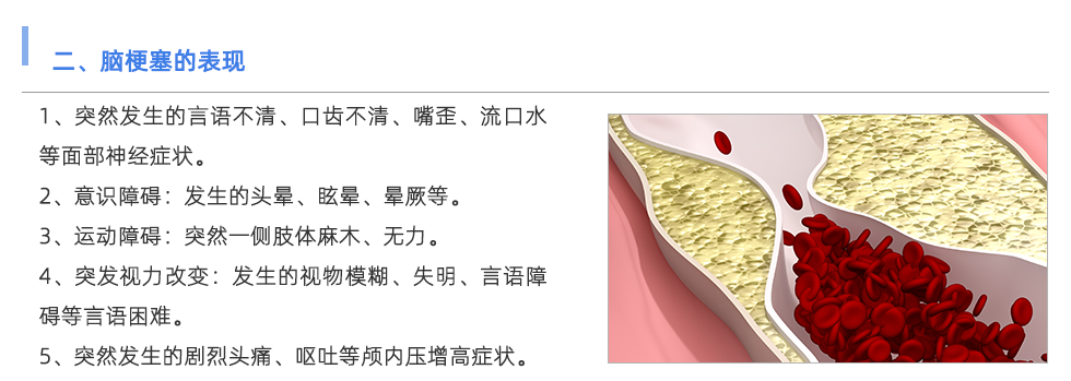 动脉硬化检测仪