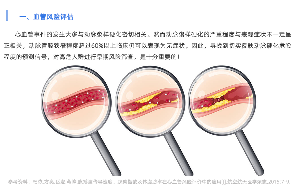 脉搏波速测定仪