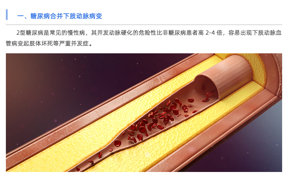 动脉硬化检测仪