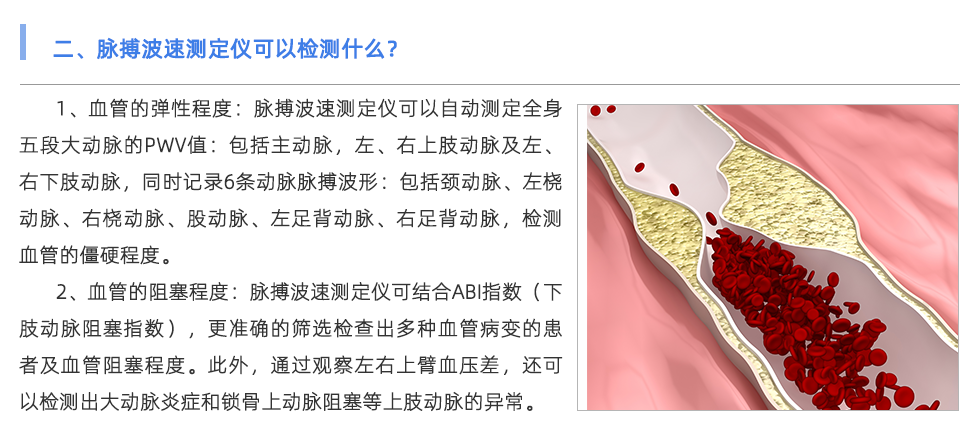 脉搏波速测定仪