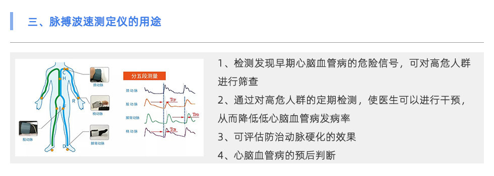 脉搏波速测定仪