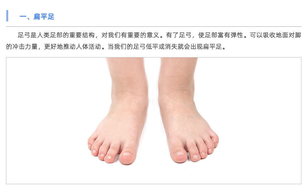定制鞋垫