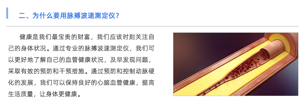 脉搏波速测定仪