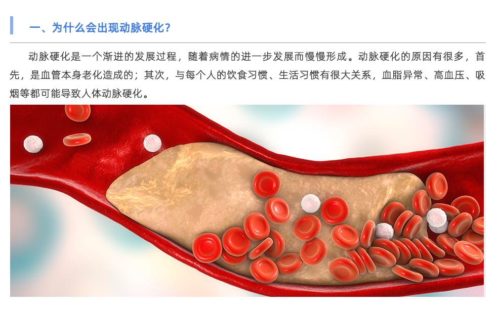 动脉硬化分析仪