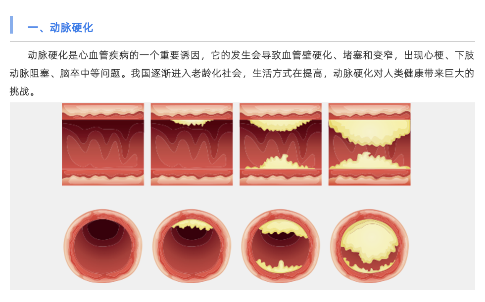 动脉硬化检测仪