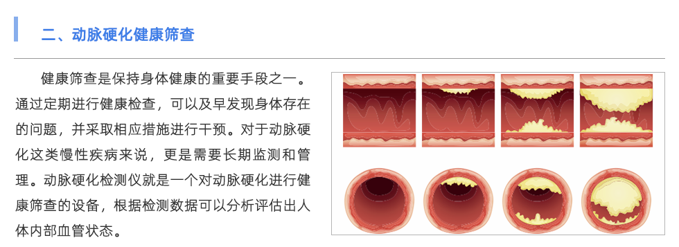 动脉硬化检测仪
