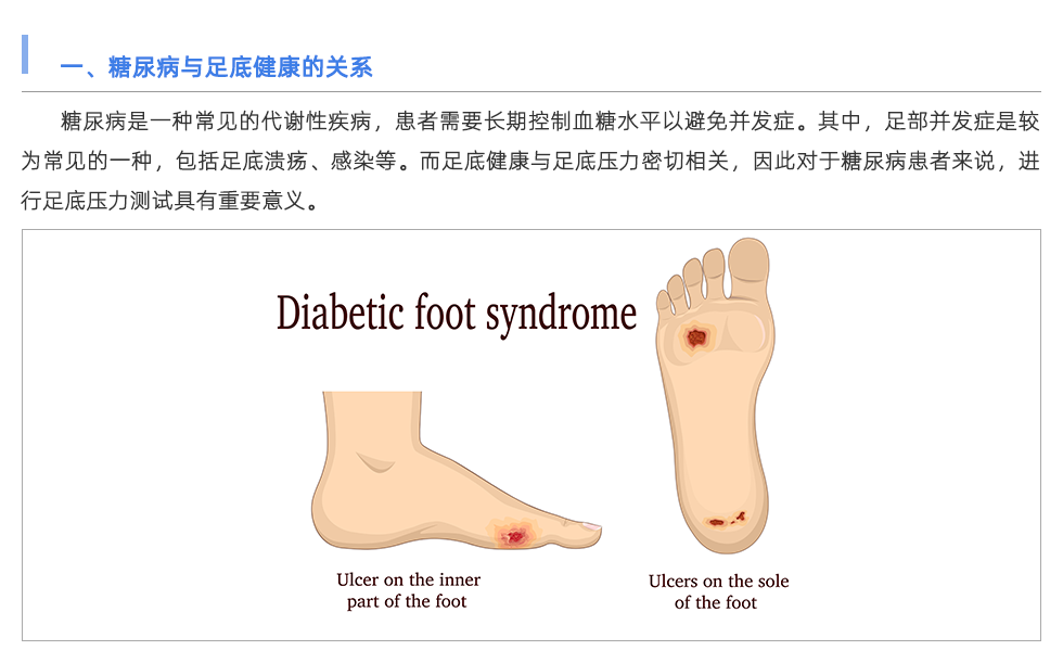 足底压力测试仪