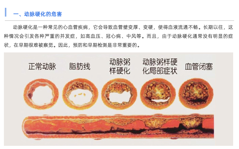 脉搏波速测定仪