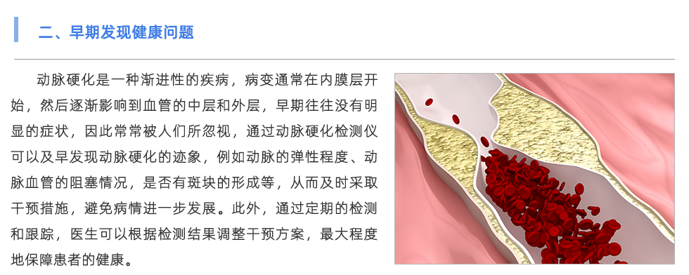 动脉硬化检测仪