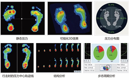 足底压力分析仪