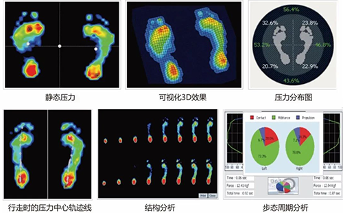足底压力检测仪
