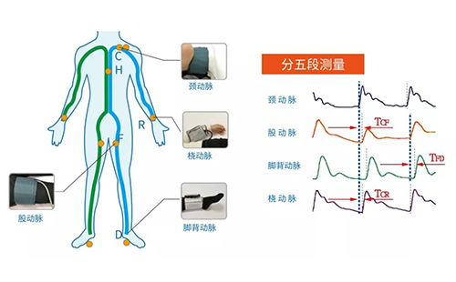 动脉硬化检测仪