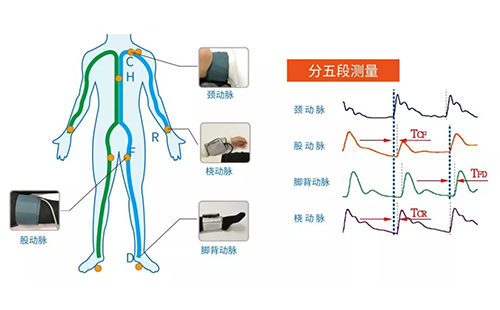 脉搏波速测定仪