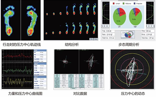 足底压力检测仪