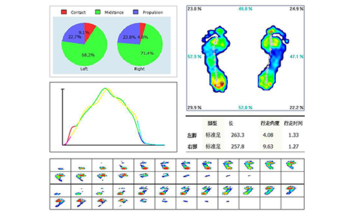 足底压力分析仪