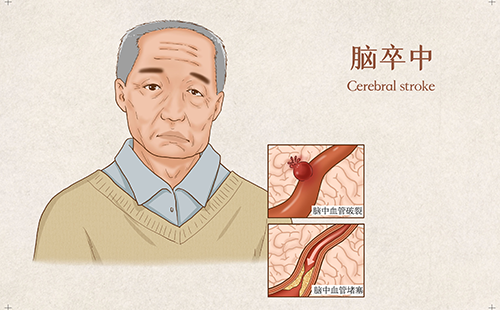 脉搏波速测定仪