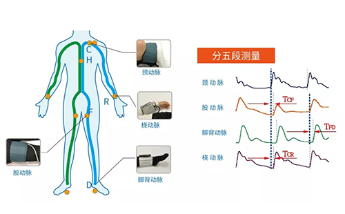 脉搏波速测定仪