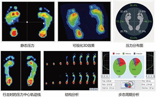 足底压力分析仪