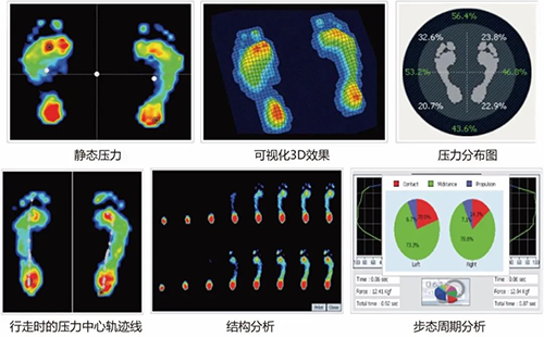 足底压力分析系统