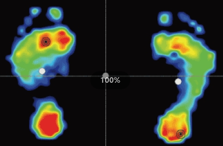 足底压力检测仪