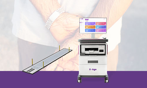 肌少症风险评估仪