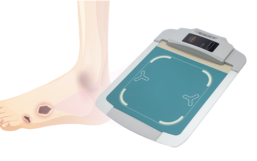 足底压力测试仪